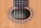 Student L-2C Op Lutes + 9534 Gigbag