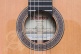 Concert 10Fp Piñana Flamenco + 9557 Case