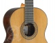 Concert 9P + 9557 Case