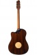 Aeg-1 Sunburst